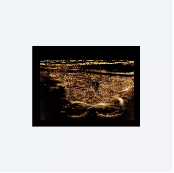 ultrasound image