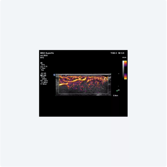 ultrasound image of a baby
