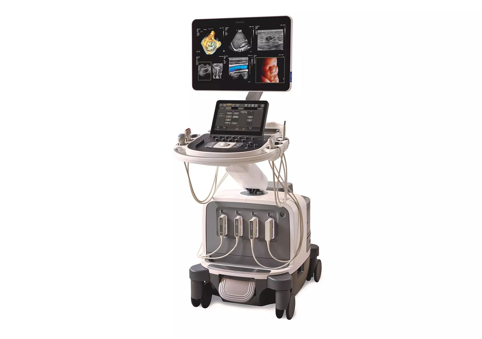 an ultrasound machine