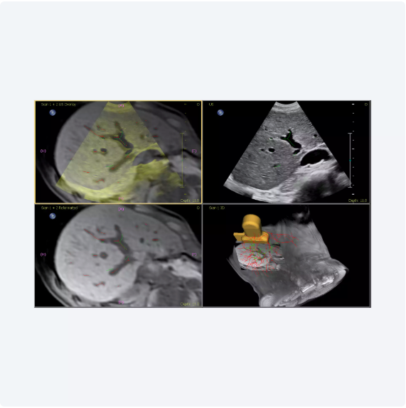 ultrasound image