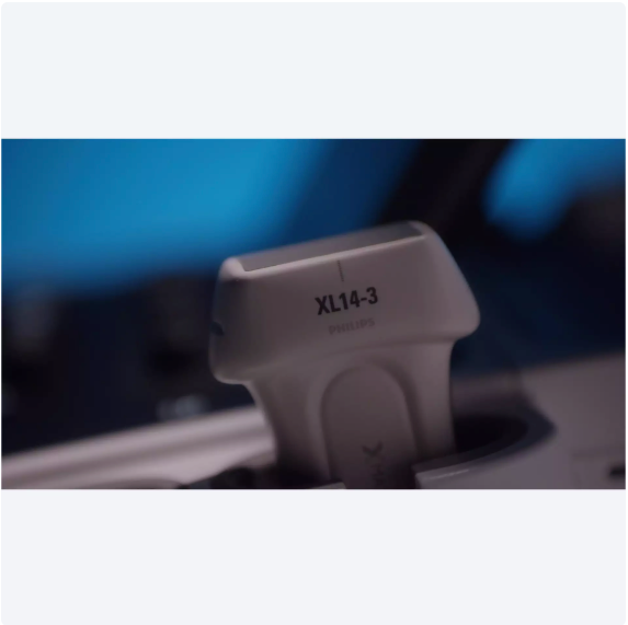 ultrasound product
