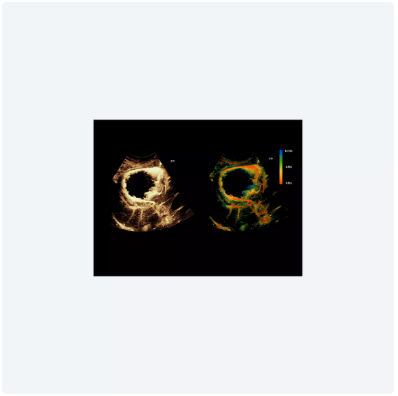 ultrasound image