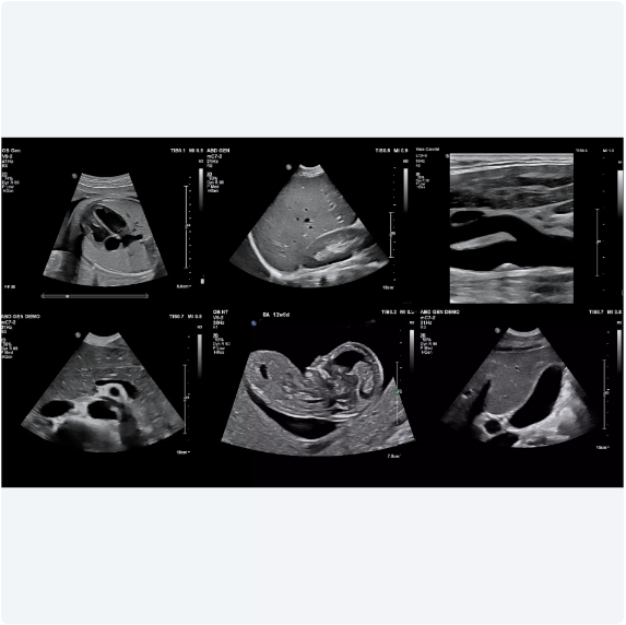ultrasound image of a baby