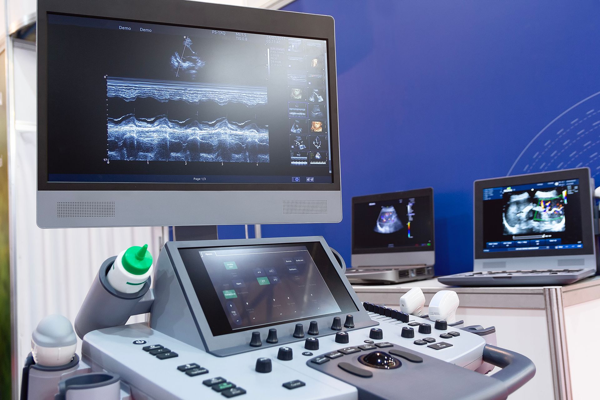an ultrasound machine