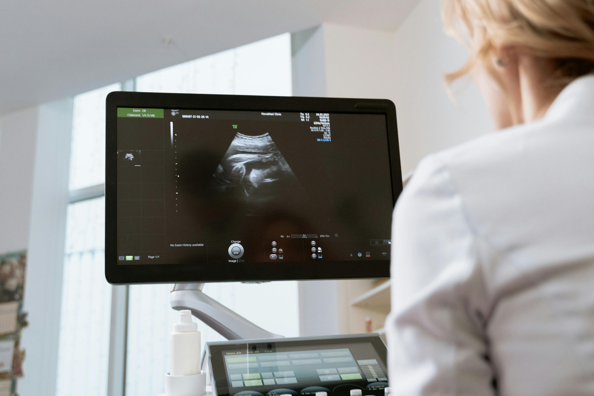 a medical technician reviewing an ultrasound monitor
