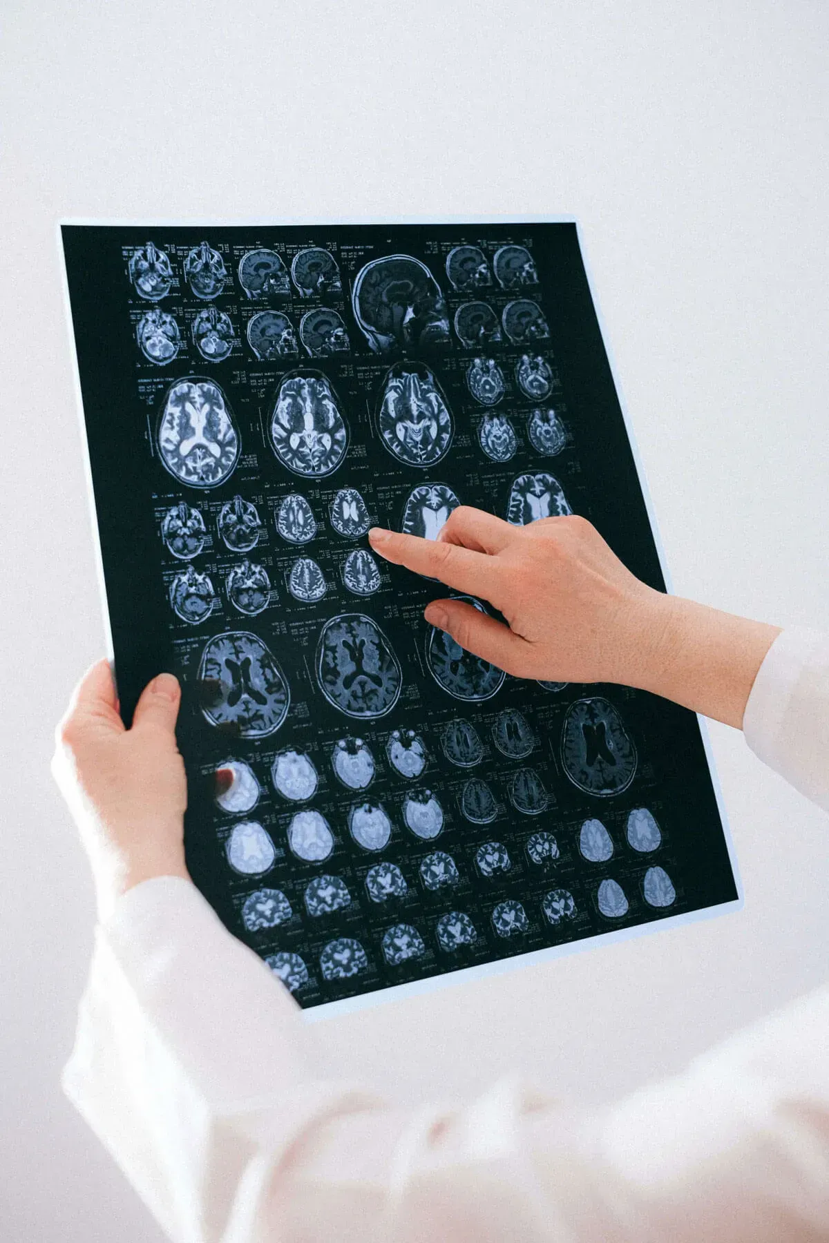 Person holding and pointing to brain scan images, evaluating the results.