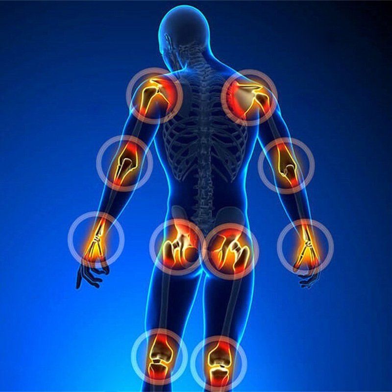 Terapia