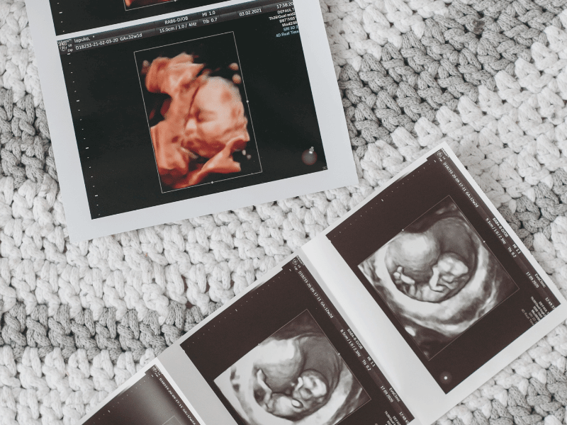 prenatal doula care in Brantford