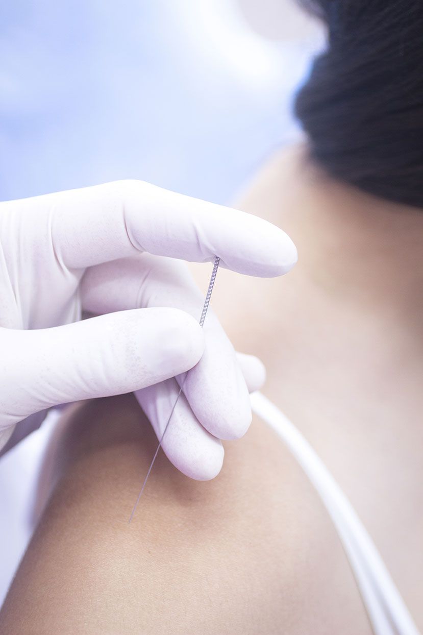 Gloved Hand Holding A Small, Thin, Needle — Integrate Health In Ooralea, QLD