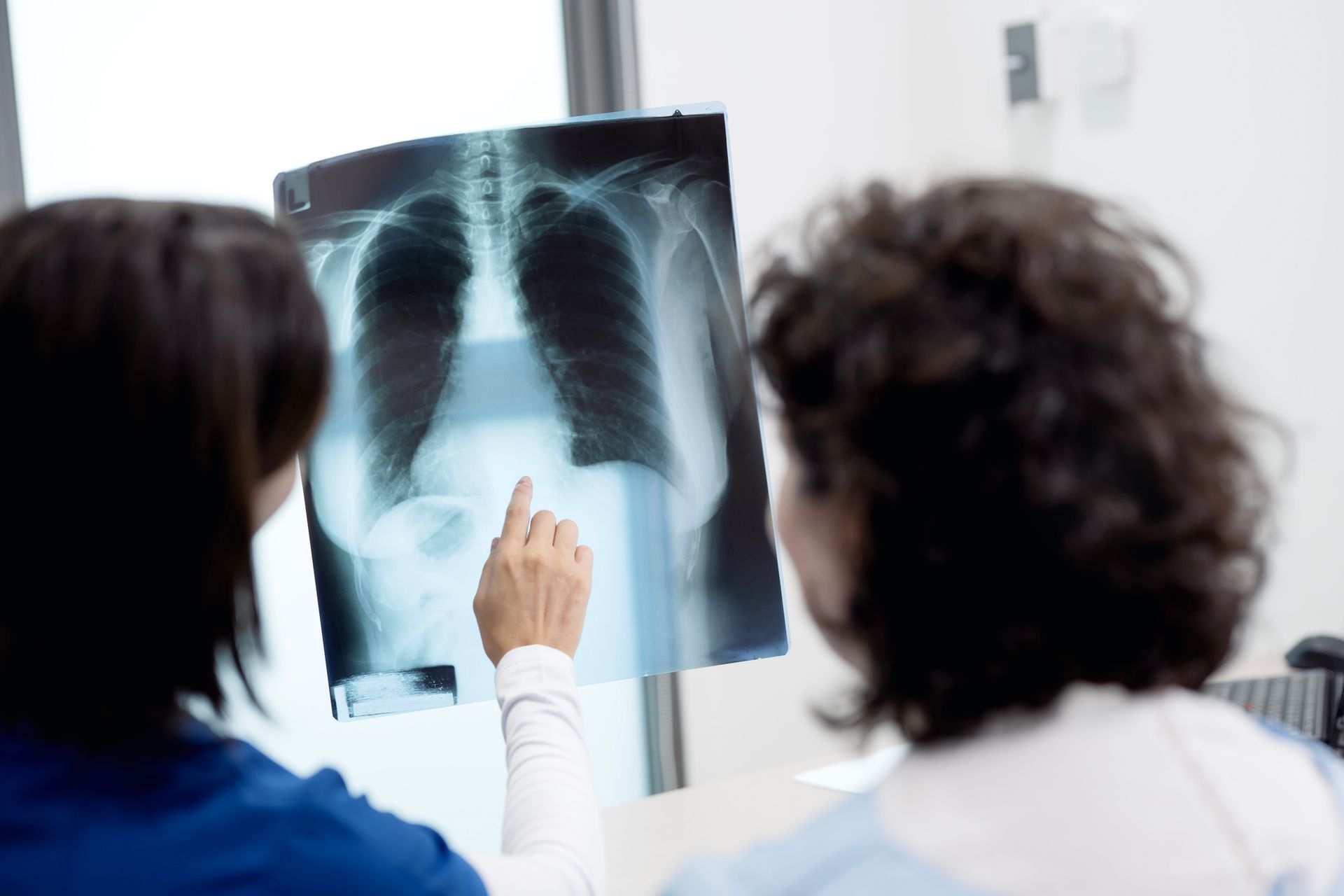 Two medical professionals examining a chest X-ray in a clinical setting.