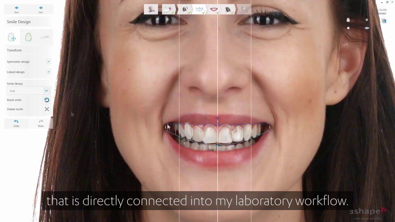 A close up of a woman 's face with braces on her teeth.