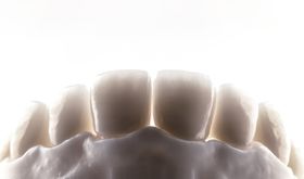 A close up of a model of a person 's teeth on a white background.