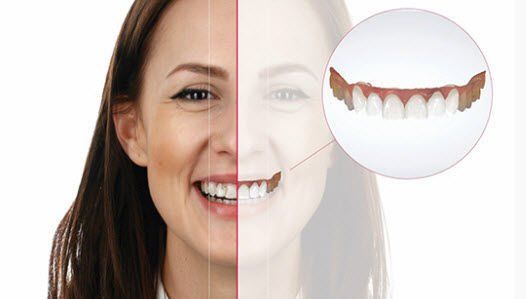 A half of a woman 's face is shown with a picture of her teeth.
