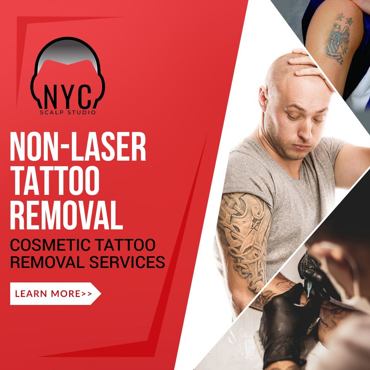 Scalp Micropigmentation Brooklyn, & New York City NY NYC Scalp Studio