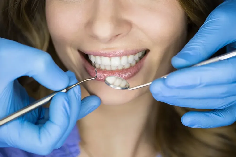 White Teeth Of A Woman — Runcorn, QLD — Runcorn Dental White Teeth Of A Woman — Runcorn, QLD — Runcorn Dental