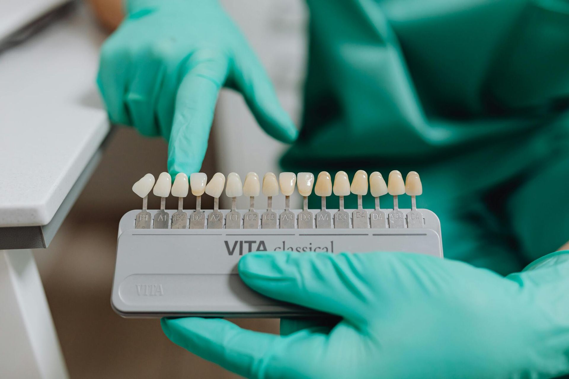 Dental worker in green gloves holds a VITA classical shade guide for teeth color comparison.