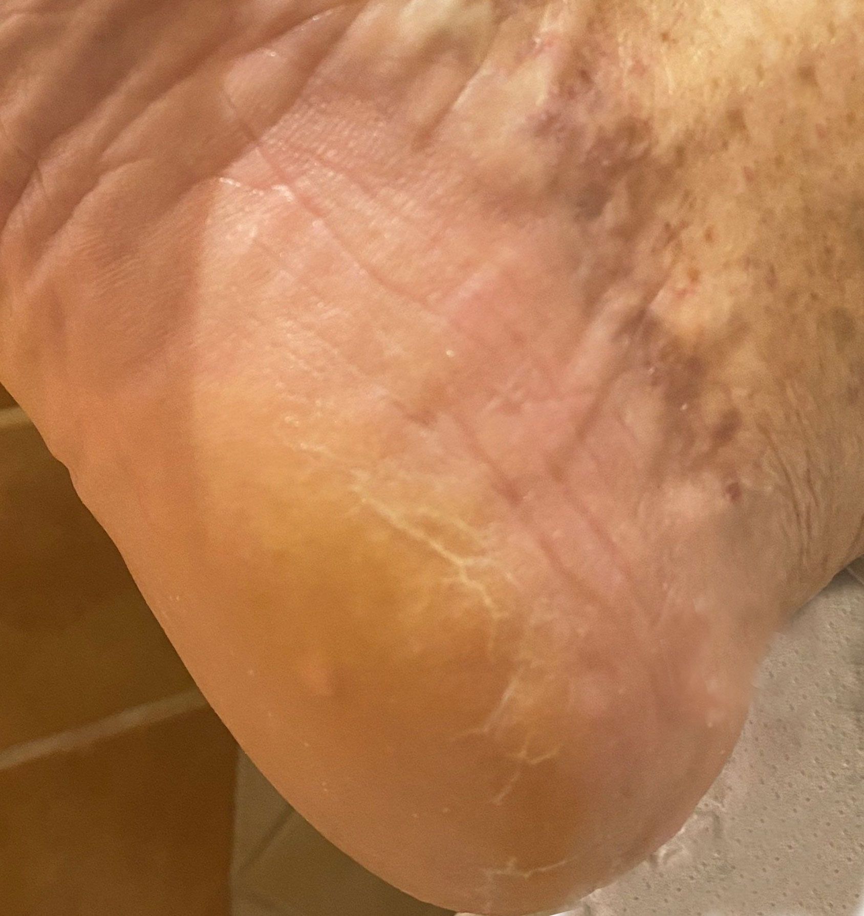 foot after pedicure