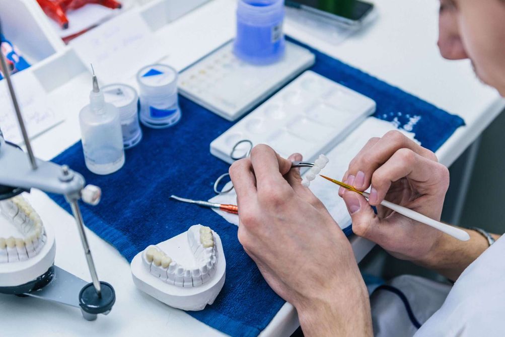 protesi orali per implantologia