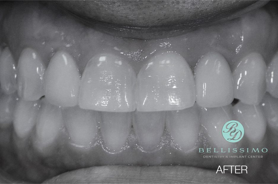 A black and white photo of a person 's teeth with the words