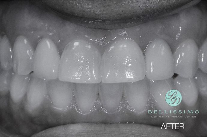 A black and white photo of a person 's teeth with the words