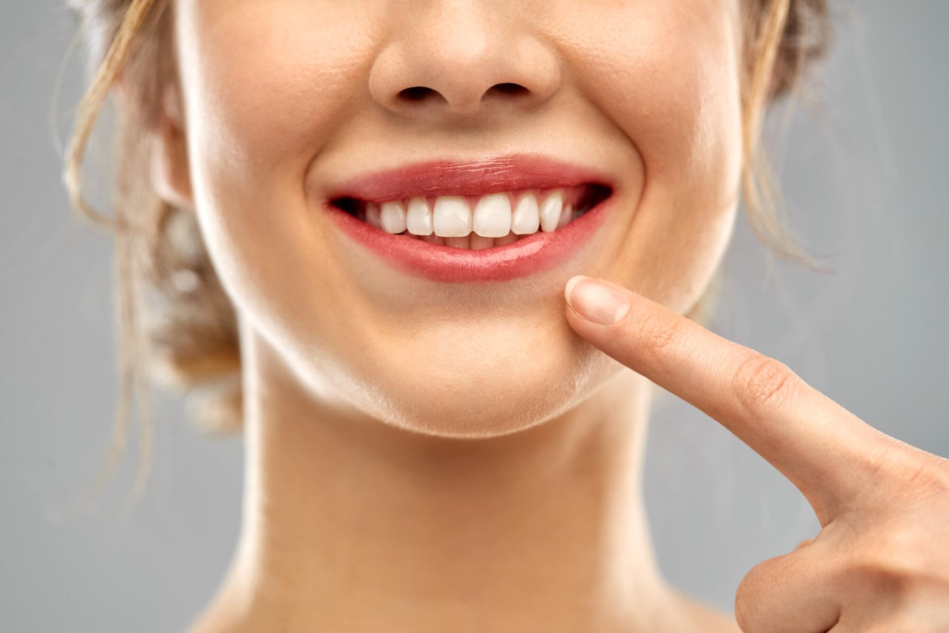 Woman pointing to her bright, white teeth and smiling broadly.
