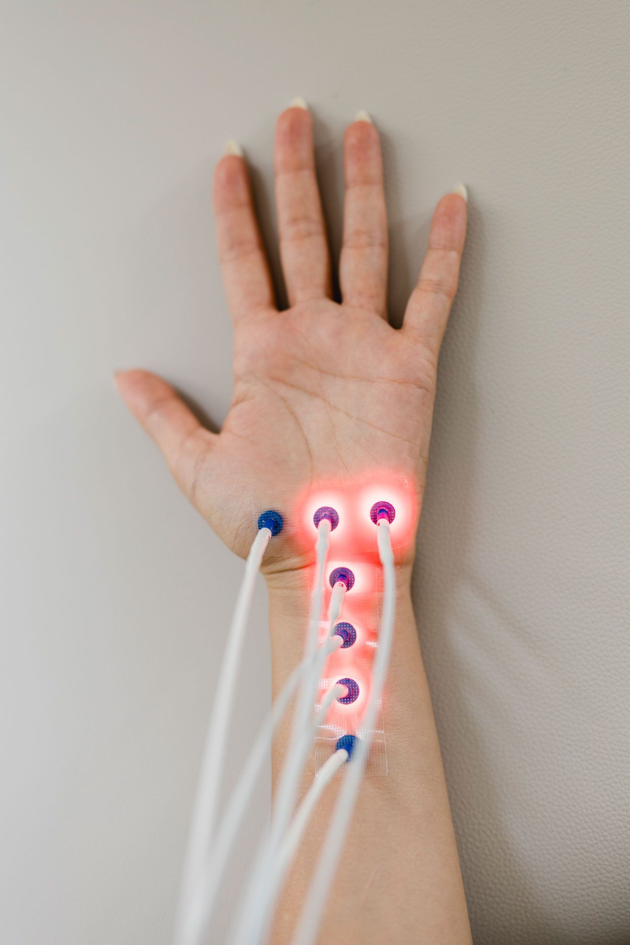 Ein Arm mit Lasernadeln
