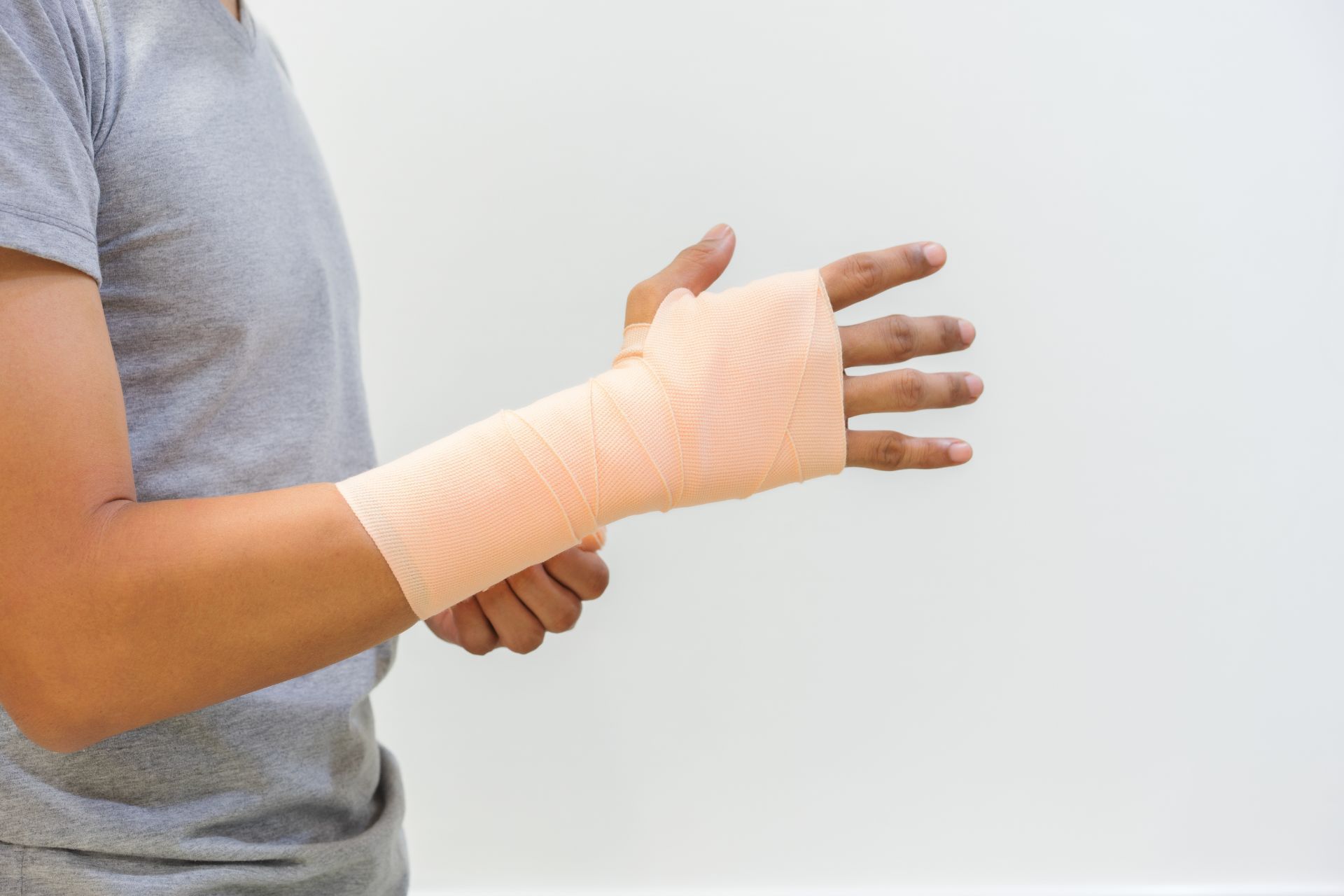 Woman with cast on