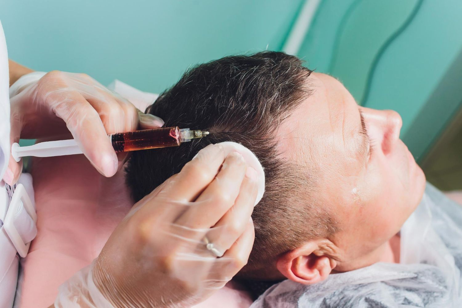 Injecting treatment into a man’s scalp at a clinic