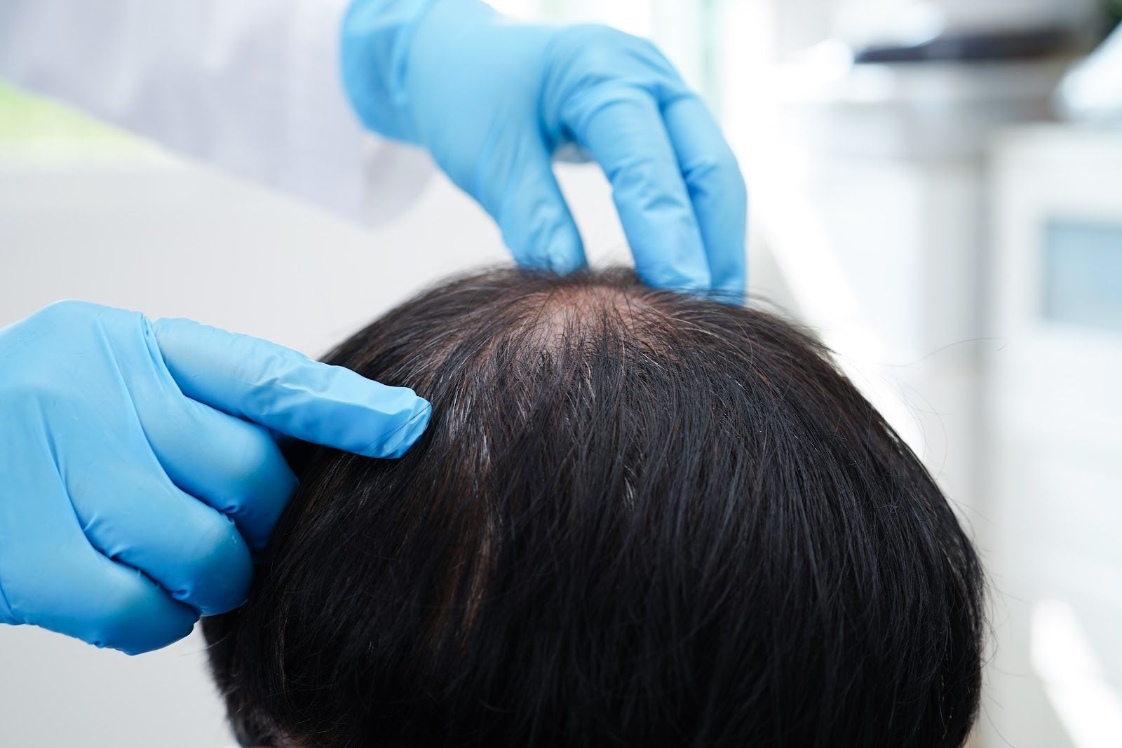 Gloved hands part hair on a scalp during a medical examination