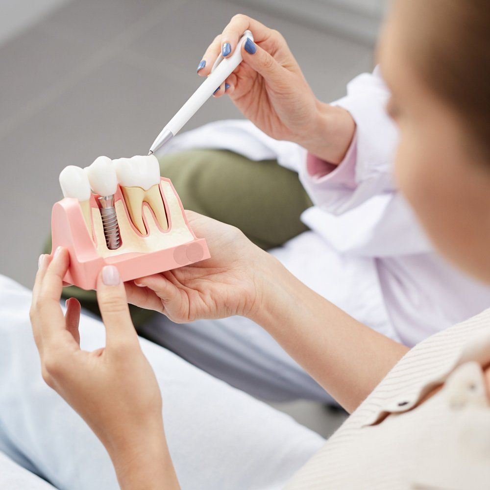 Explaining Dental Implant — Sarasota, FL — Sterling Dental Explaining Dental Implant — Sarasota, FL — Sterling Dental