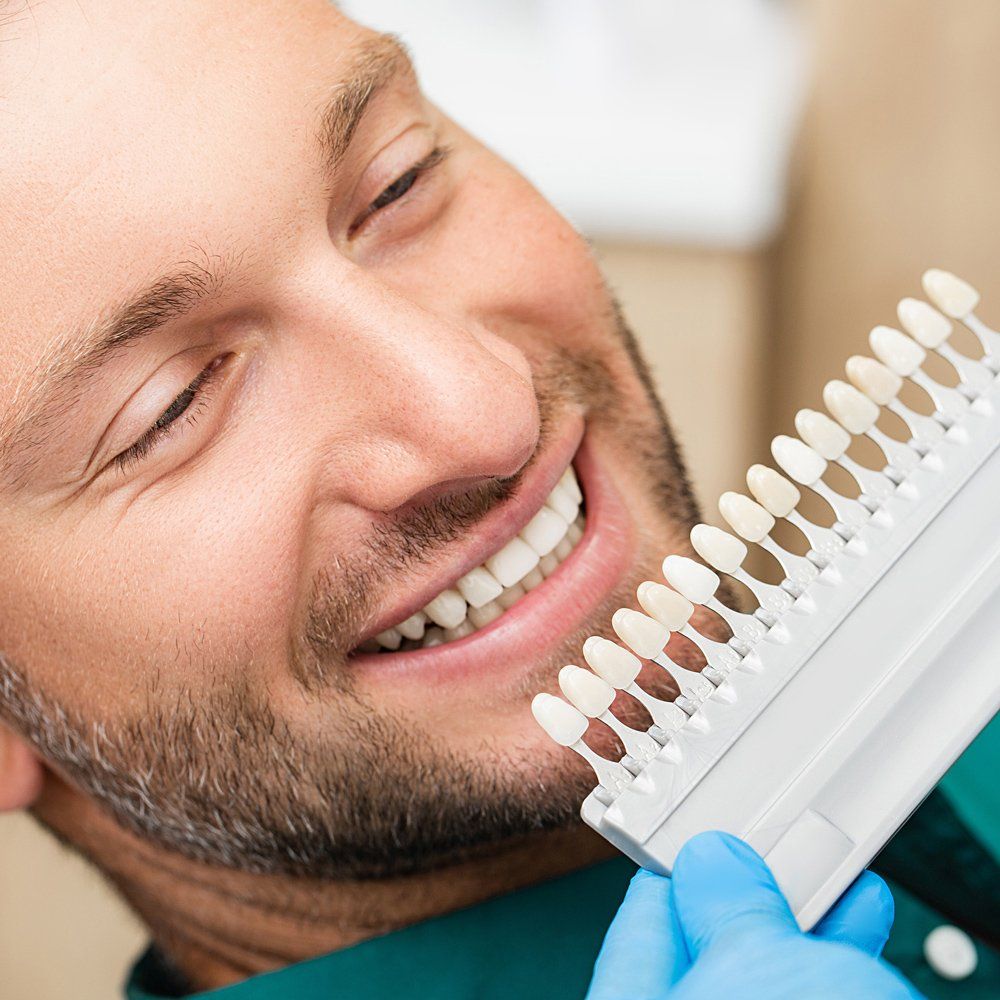 Dental Veneer — Sarasota, FL — Sterling Dental Dental Veneer — Sarasota, FL — Sterling Dental