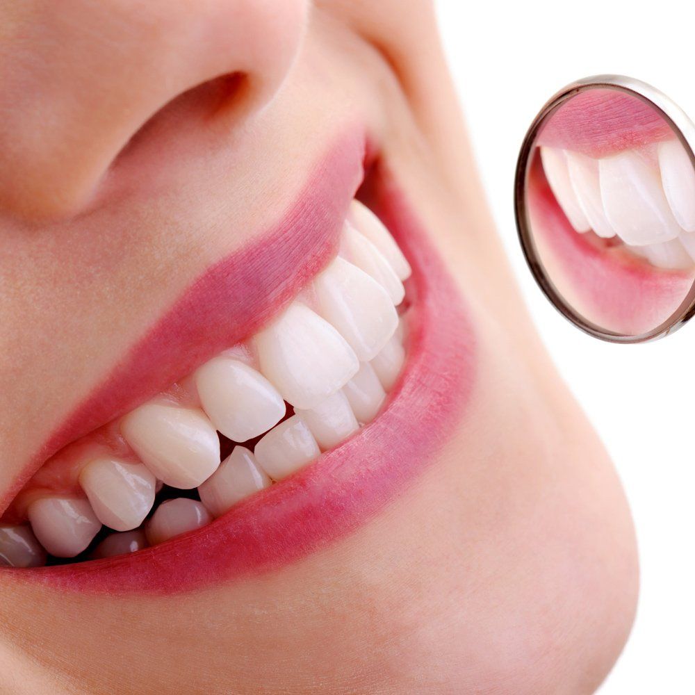 Woman With White Teeth — Sarasota, FL — Sterling Dental Woman With White Teeth — Sarasota, FL — Sterling Dental