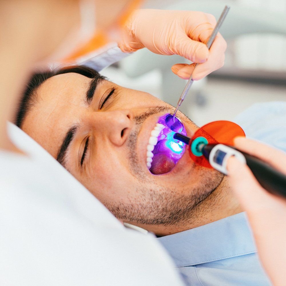 Dental Sealant — Sarasota, FL — Sterling Dental Dental Sealant — Sarasota, FL — Sterling Dental
