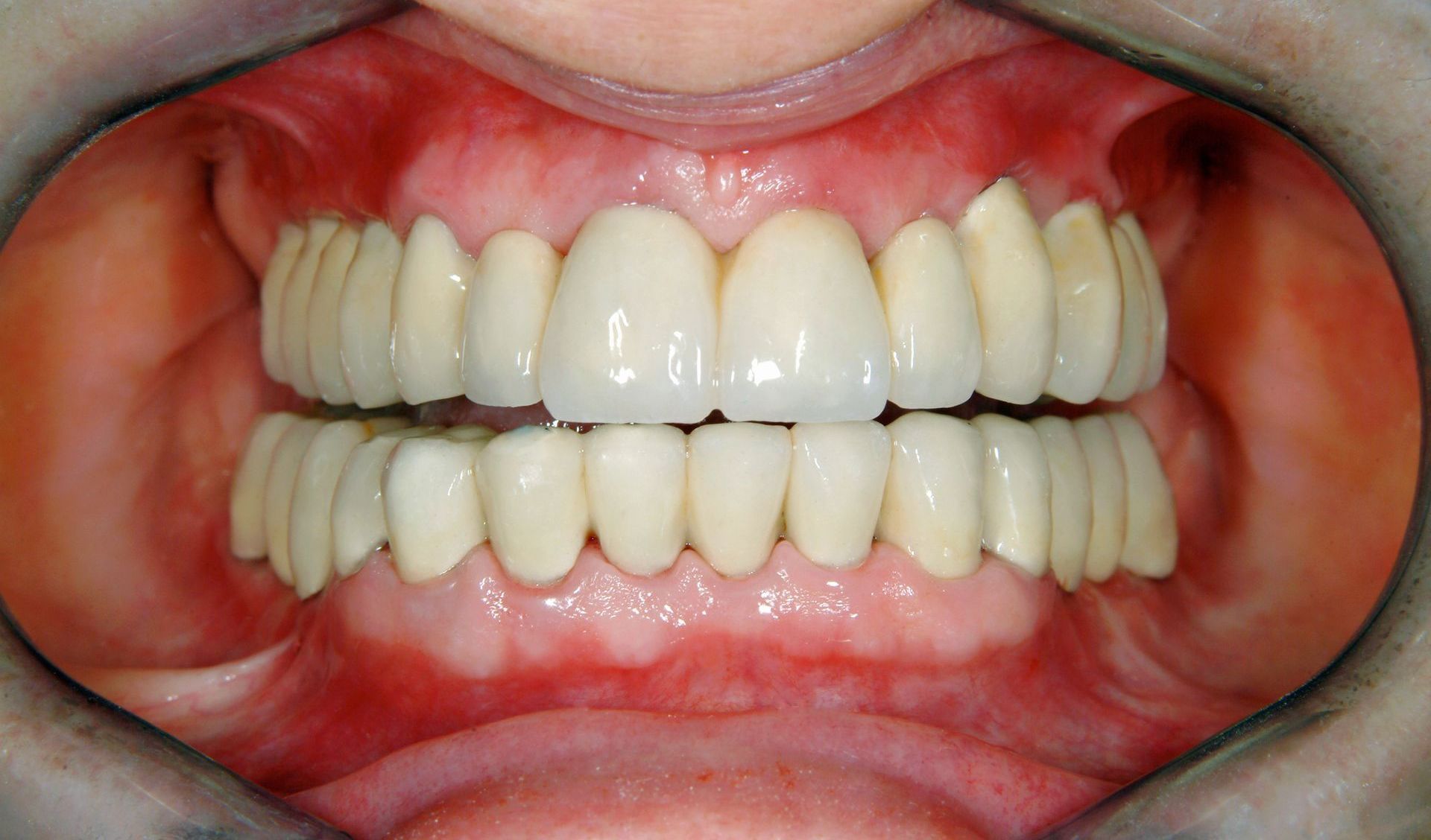 after smile