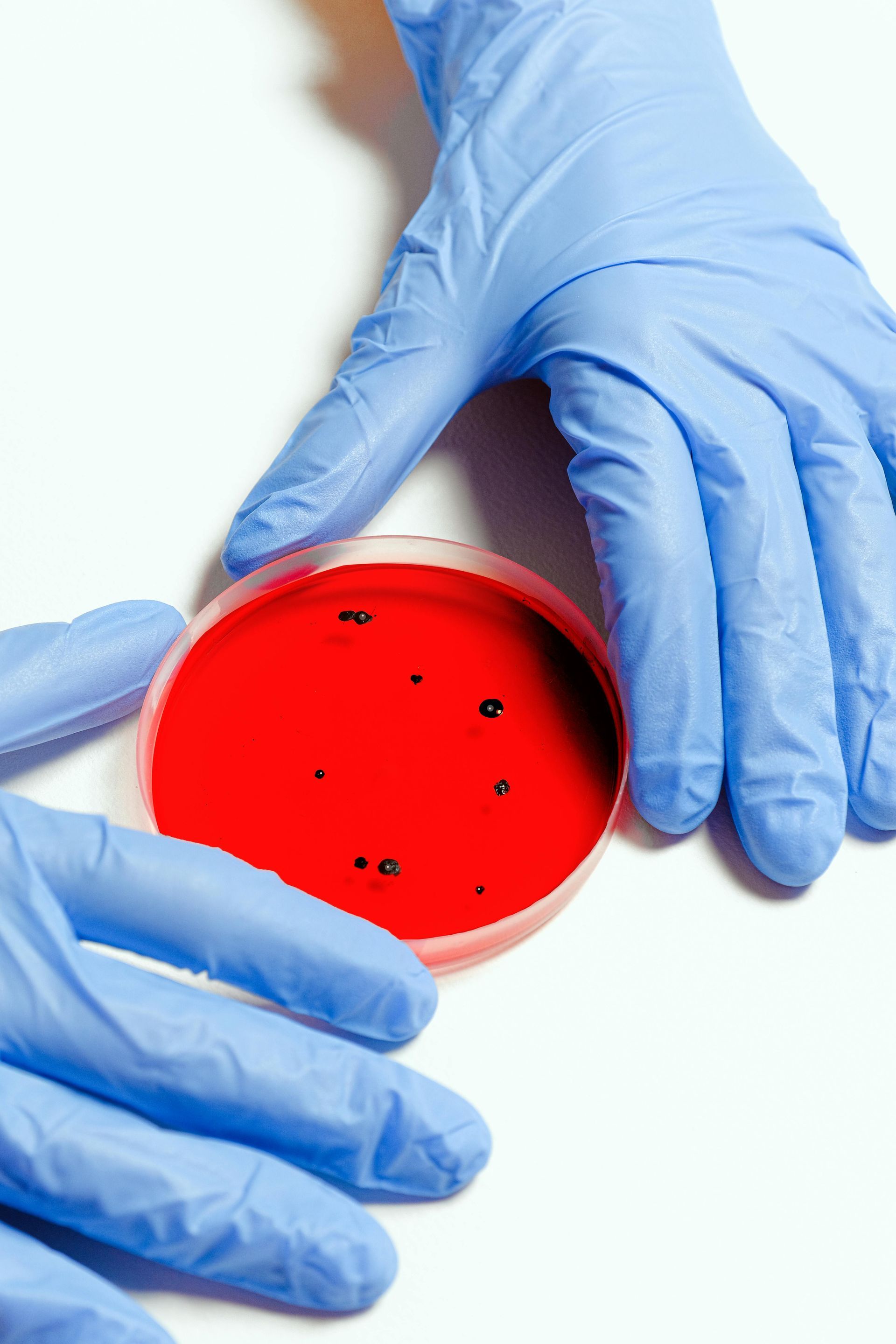 Il nuovo virus HMPV