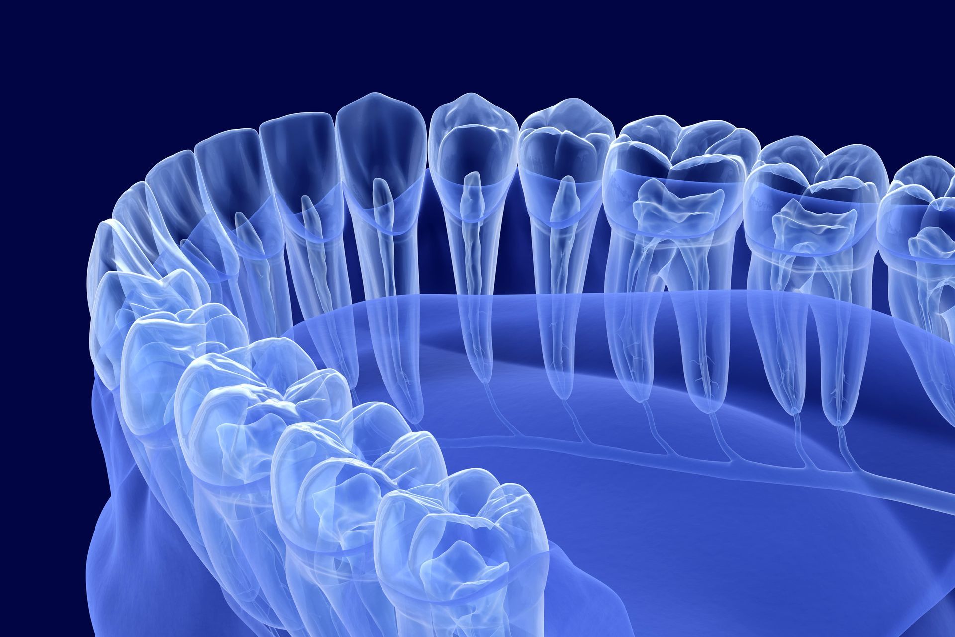 Digital illustration of a dental X-ray.