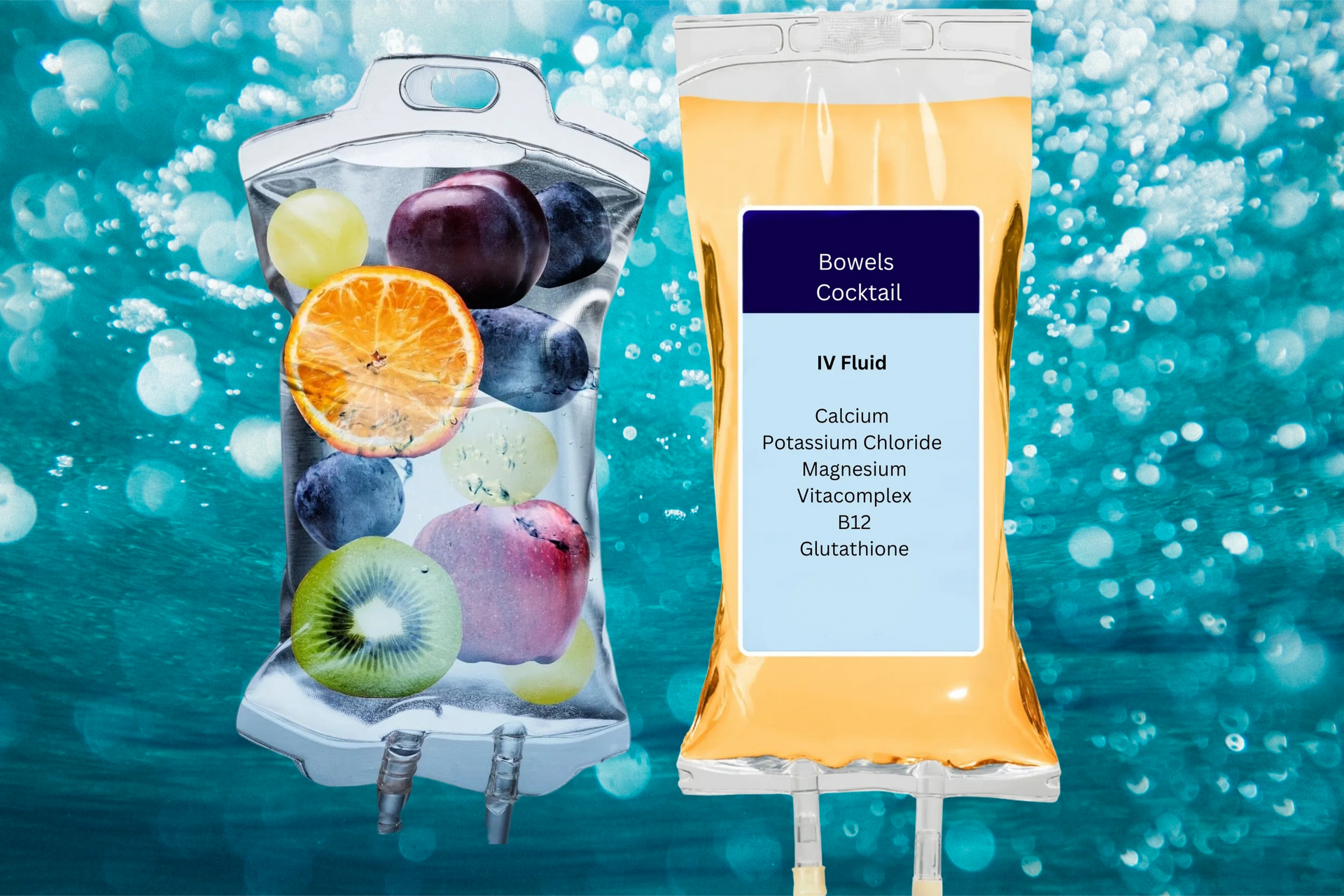 iv drip bag of multi-vitamin solution
