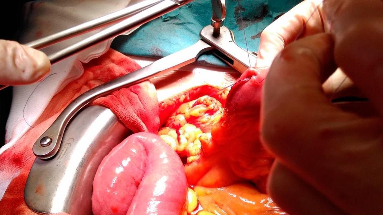 DR. RAÚL GARCÍA ACOSTA - Endoscopia DR. RAÚL GARCÍA ACOSTA - Endoscopia