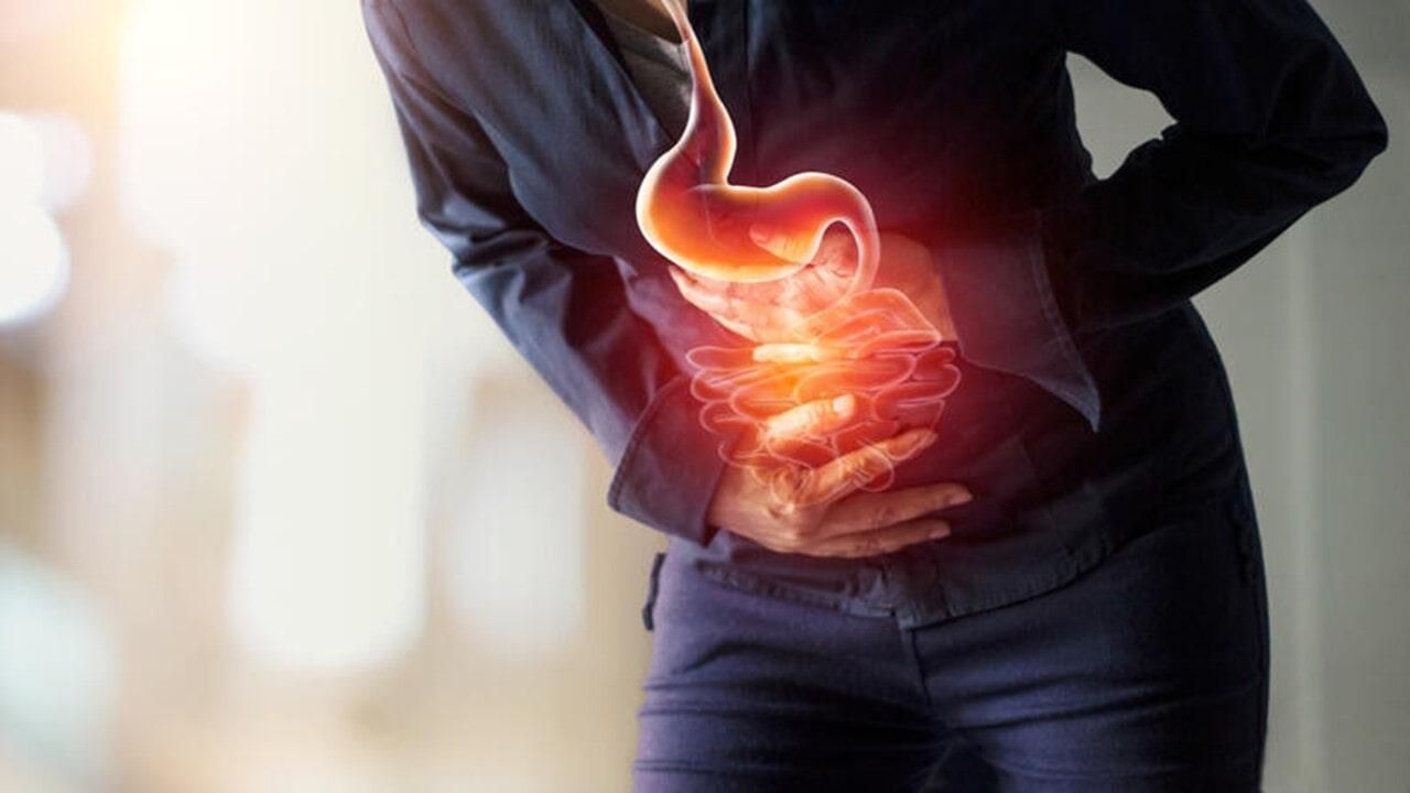 DR. RAÚL GARCÍA ACOSTA - Cirugía de hernia hiatal DR. RAÚL GARCÍA ACOSTA - Cirugía de hernia hiatal