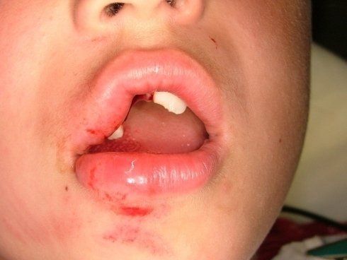 intervento di traumatologia dentale