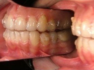 arcata dentale