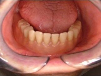 cura dei denti