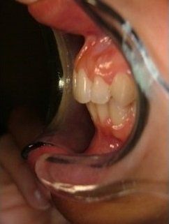 intervento ai denti