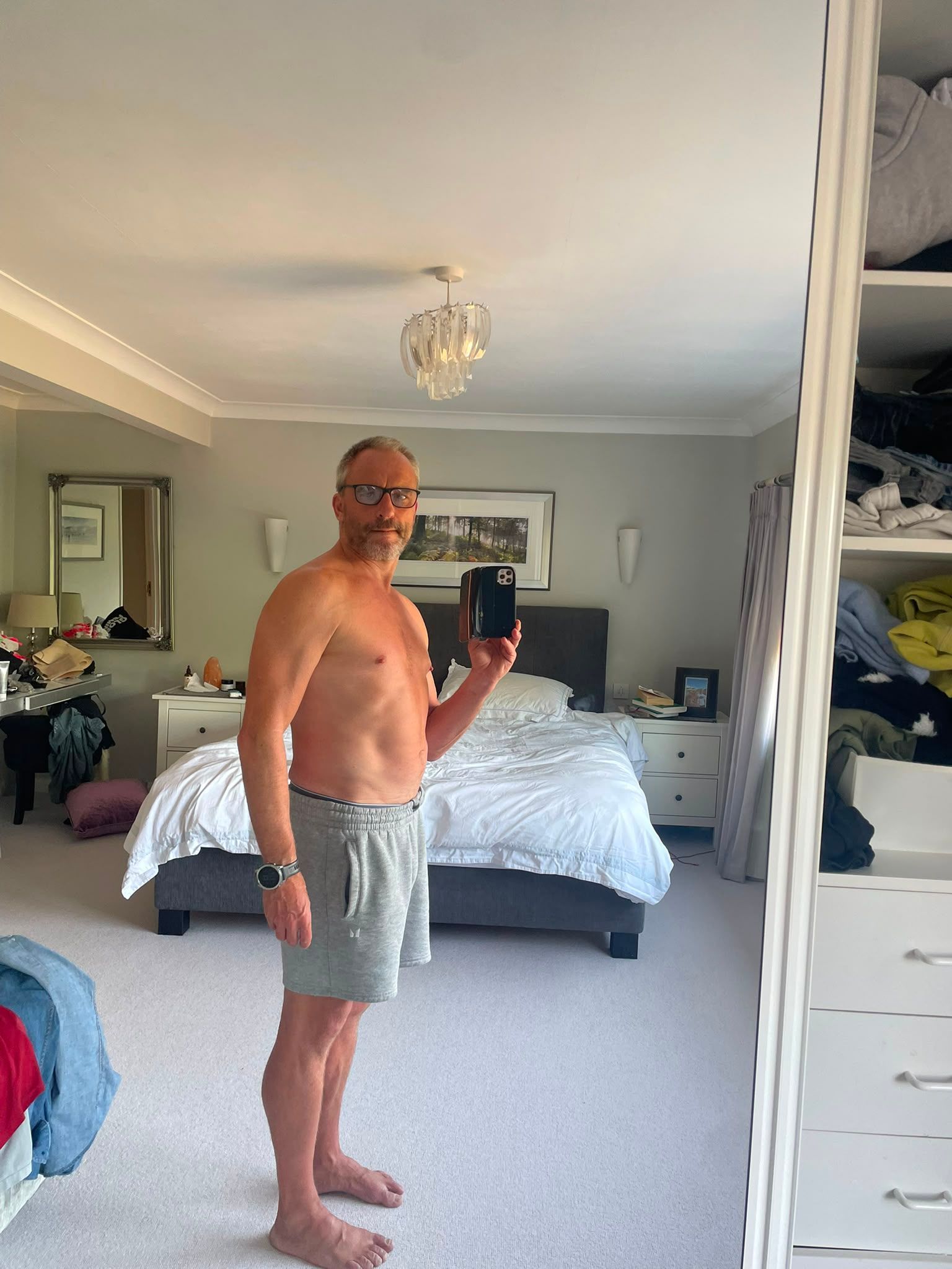 Before Images of Tim