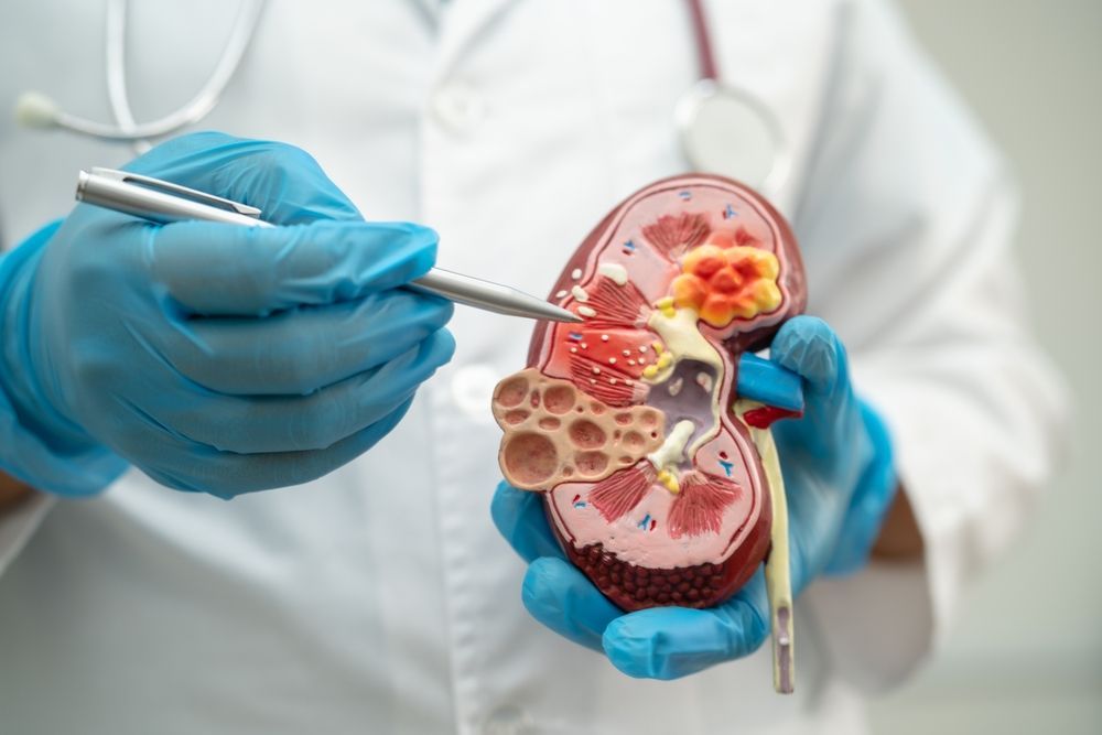 A doctor is holding a model of a kidney with a pair of scissors.