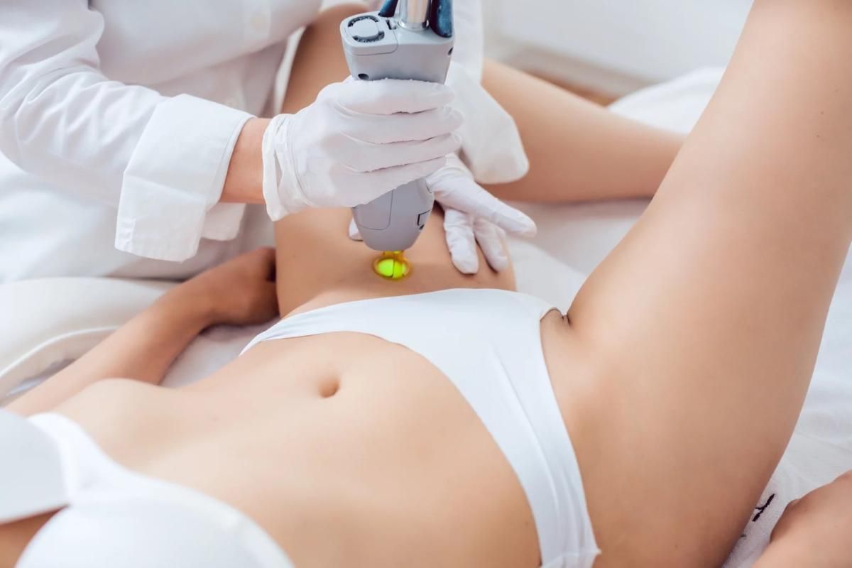 Laser hair removal treatment on a person's pubic area. A medical professional uses a device.