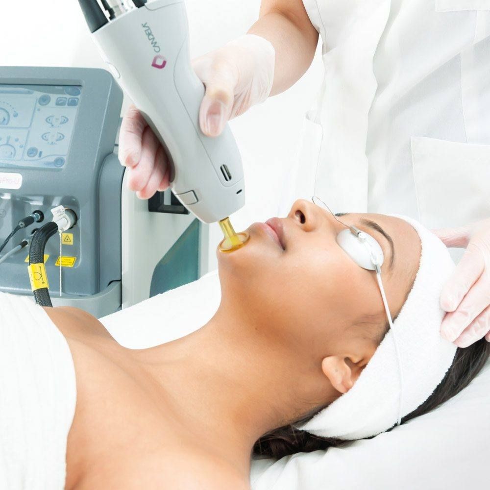 Person receiving facial laser treatment; medical equipment used by gloved hands.
