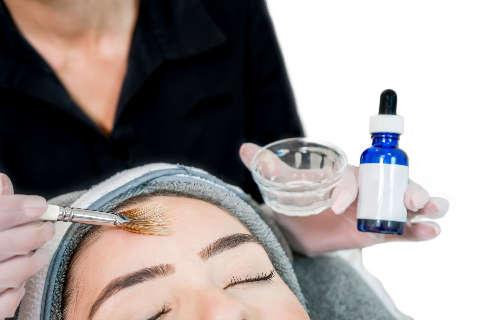 Person receiving a facial peel treatment. Aesthetican applies liquid with a brush.