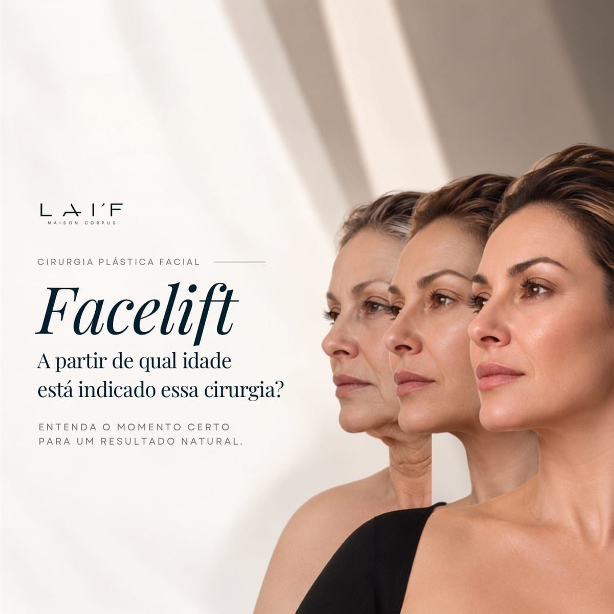 Deep Plane Facelift
