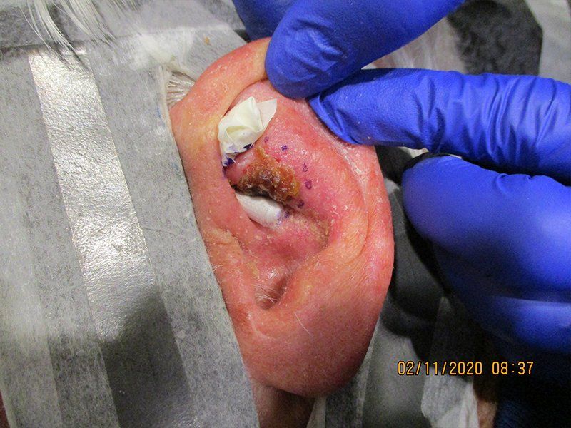 Pre-Treatment